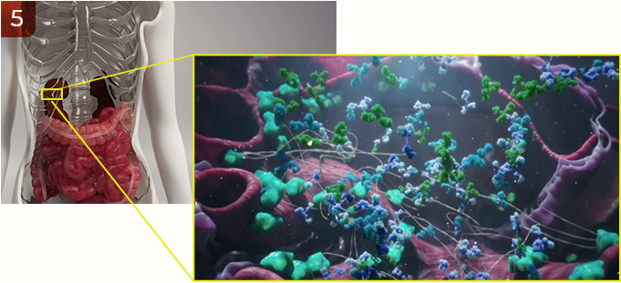 renal-function-deterioration-iga-nephropathy