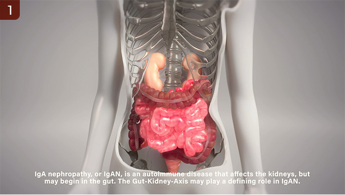 iga-nephropathy-mucosal-surfaces